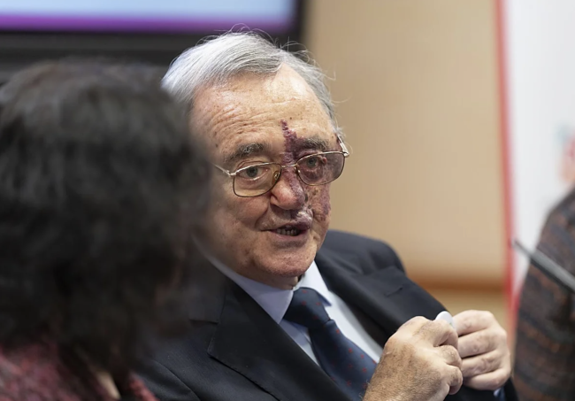 스페인 과학자들이 3가지 약물의 조합으로 췌장암을 완전히 박멸했습니다